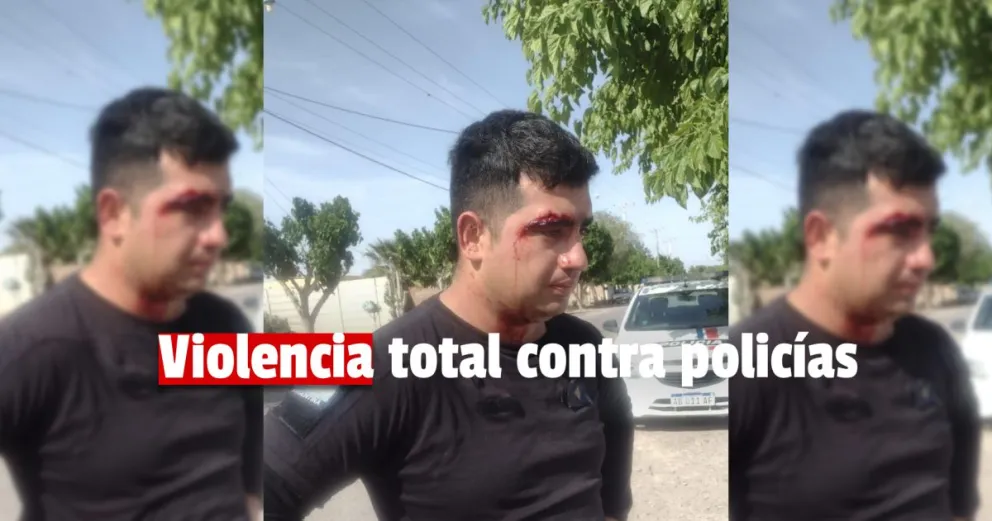Dos familias atacaron a policías y un oficial terminó hospitalizado 