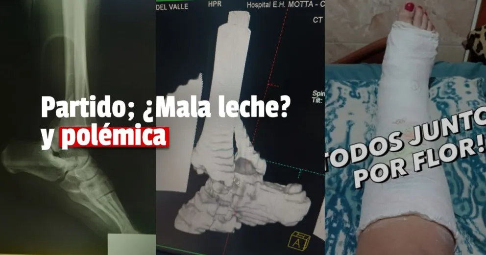 Una jugadora de handball sanjuanina sufrió una dura lesión y recibe donaciones económicas para poder operada 