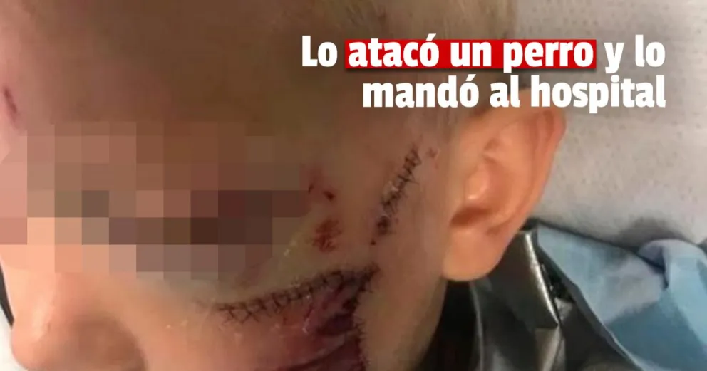 Pocito: un perro atacó a un bebé de un año y medio
