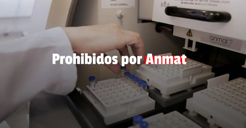 Anmat prohibió tres alimentos por infringir requisitos sanitarios 