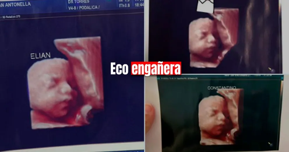 Estafa en una clínica privada: entregaban la misma foto de la ecografía 5D para las pacientes